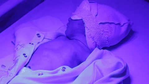 Newborn under ultraviolet lamp. Stock Footage 126828002