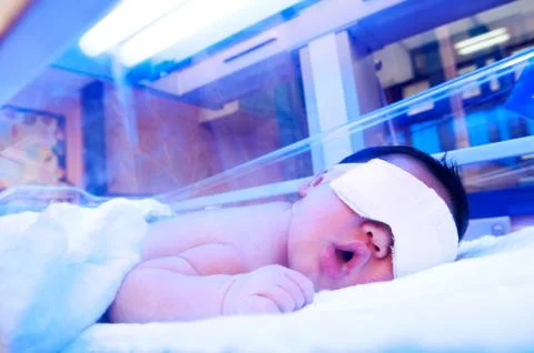 Newborn under ultraviolet light Stock Photos