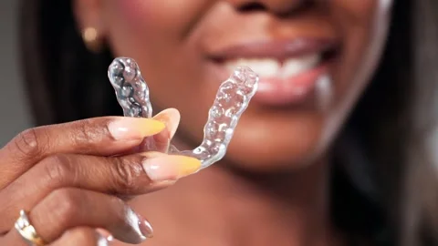 Night Guard Aligners: Clear Teeth Orthodontics Stock Footage 318758937
