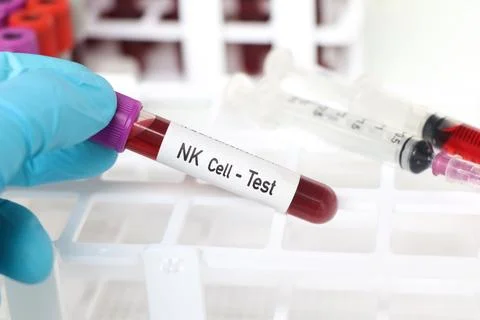 NK Cell test, blood sample to analyze in the laboratory Фото