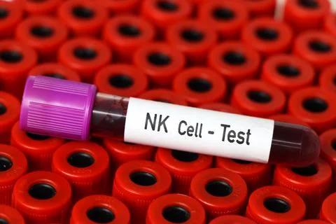 NK Cell test, blood sample to analyze in the laboratory 스톡 사진