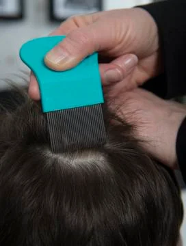 No head lice Stock Photos