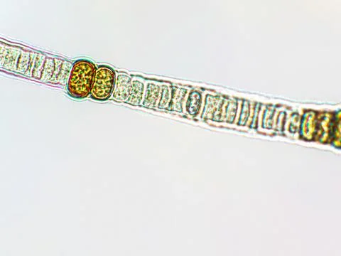 Nodularia sp. toxic algae under microscopic view x100 Foto stock