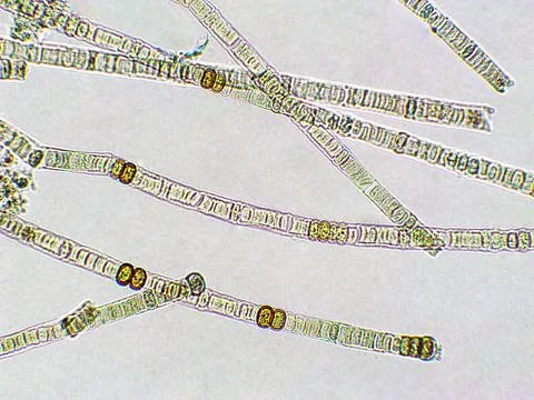 Nodularia sp. toxic algae under microscopic view x40 Foto stock