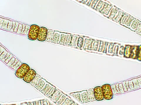Nodularia sp. toxic algae under microscopic view x100 Stock Photos