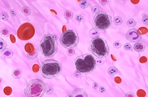 Non-hodgkin lymphoma (NHL) cells in the blood flow Stock Illustration