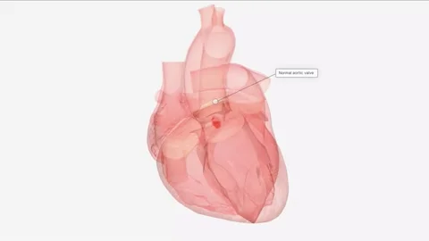 Normal Aortic Valve Function . Stock Footage 230471056