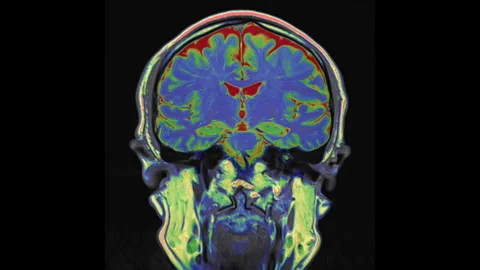 Normal Brain Stock Videos – Royalty-Free HD & 4K Videos | Pond5