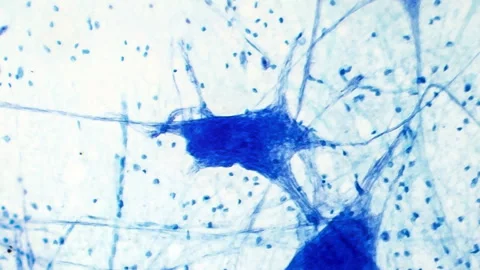 Normal brain tissue, light microscopy Stock Footage 278399013
