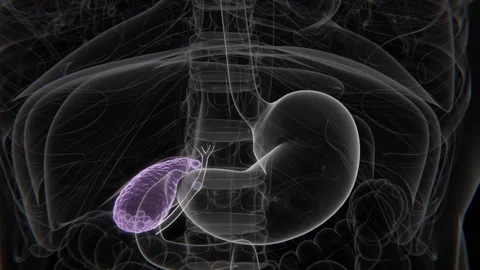Normal to Cholecystitis Indication X-Ray Video | Gallbladder Infection Video stock 328924748