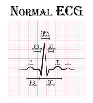 Normal ECG ( Electrocardiogram ) ( P wave , PR segment , PR interval , QRS co イラスト素材