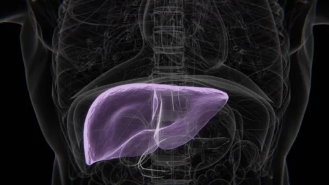 Normal to Fatty Liver indication in HD X-Ray Video | Fatty Liver Disease Stock Footage 328924886