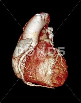 Normal heart, 3d ct scan Stock Illustration