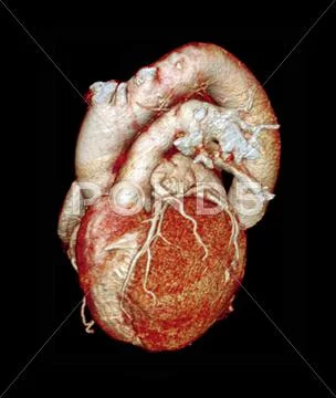 Normal heart, 3d ct scan Stock Illustration