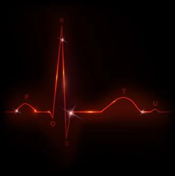 Normal heart cardiogram Stock Illustration