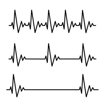 Normal heart rate linear illustration on white background Stock Illustration