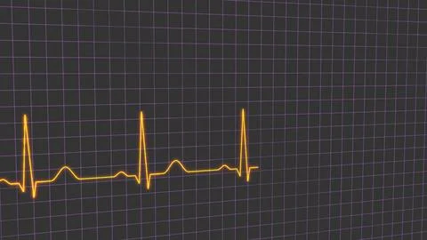 Normal heart rhythm ECG electrocardiogram of a healthy person, heart examin.. 스톡 일러스트