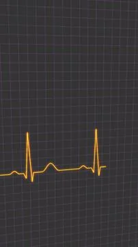 Normal heart rhythm ECG electrocardiogram of a healthy person, heart examinat イラスト素材