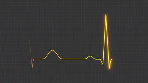Normal heart rhythm ECG electrocardiogram of a healthy person, heart examinat イラスト素材