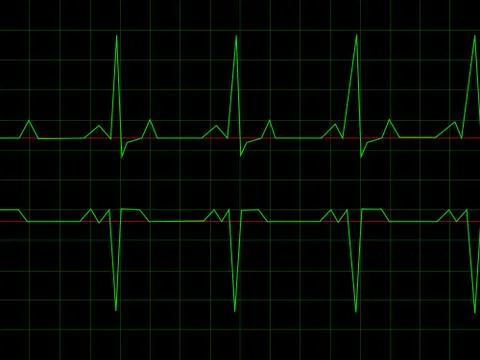 Normal Heart Rhythm イラスト素材