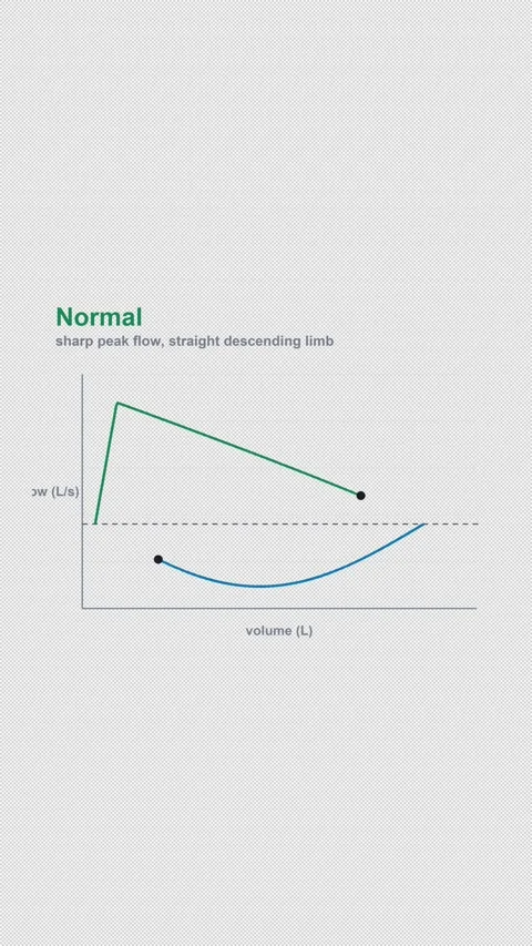 Normal Labeled Spirometry Flow Volume Loop Alpha 4K Vertical 9x16 Light Видео 339493525