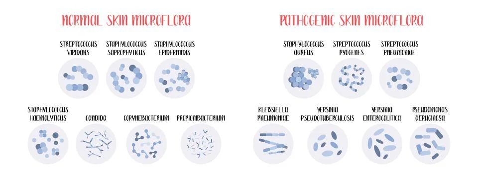 Normal, pathogenic skin microflora. Bacteria. Microbiome. Staphylococcus, Str Stock Illustration