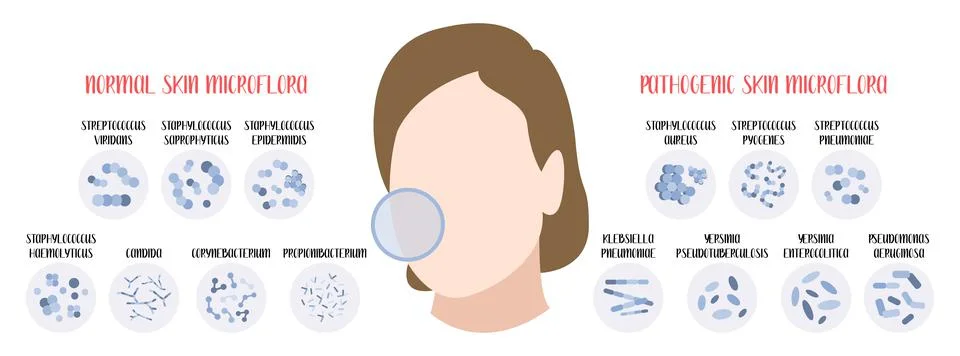 Normal, pathogenic skin microflora. Bacteria. Microbiome. Staphylococcus, Str Stock Illustration