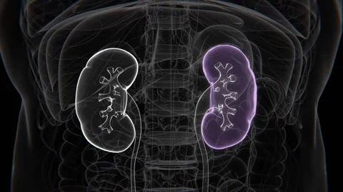 Normal to Polycystic Kidney Disease in HD X-Ray Video | Normal to Polycystic Stock Footage 328924946