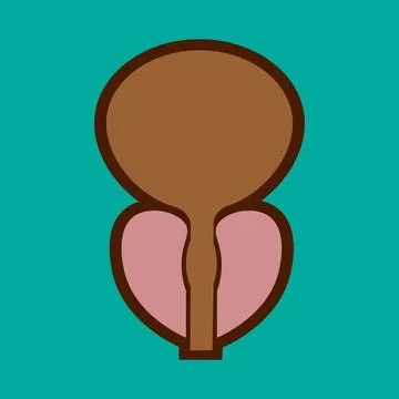 Normal prostate and acute prostatitis. Medical illustration Stock Illustration