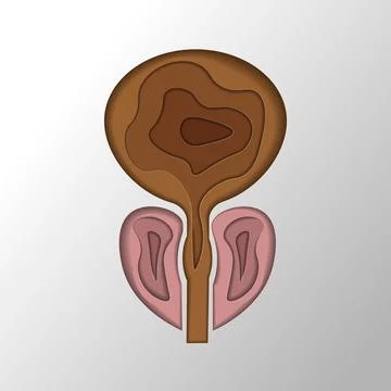 Normal prostate and acute prostatitis. Medical illustration paper cut style Stock Illustration