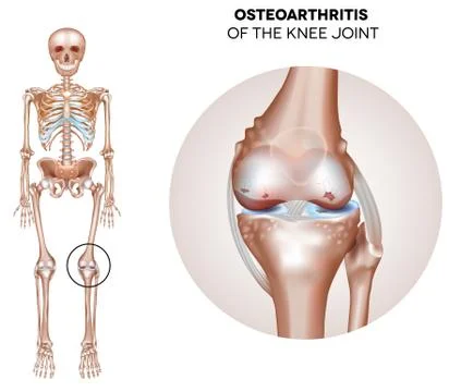Normal synovial joint anatomy Stock Illustration