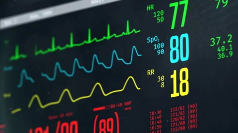 Normal vital signs on bedside ICU monitor, patient stable after heart surgery Stock Footage