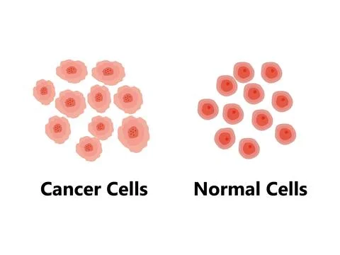 Normal vs Cancer Cell Division. Loss of normal growth control of cells. Stock Illustration
