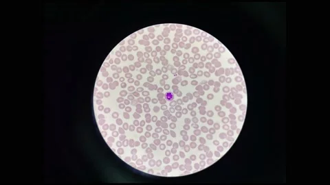 Normal white blood cell in stop motion. Stock Footage 230861787