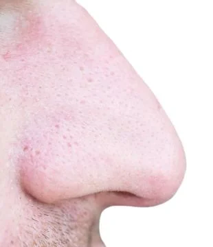 Nose Stock Photos