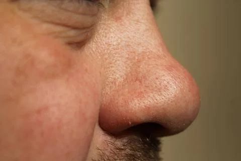 Nose Foto stock