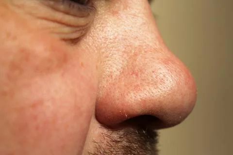 Nose Foto stock