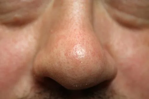 Nose Foto stock