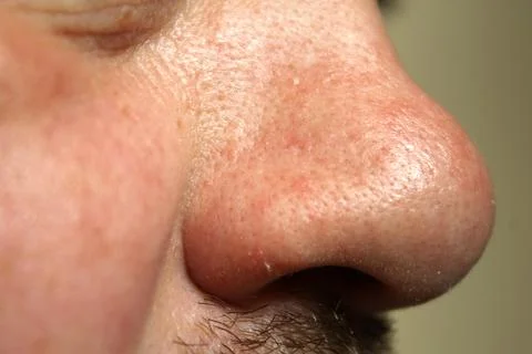 Nose Foto stock