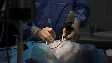 Nose surgery for a small patient Stock Footage 165013894