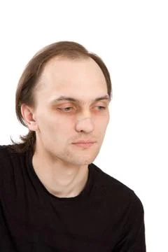 Nose trauma Stock Photos
