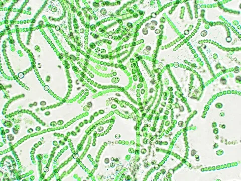 Nostoc sp. algae under microscopic view, cyanobacteria, blue-green algae Stock Footage 235703907