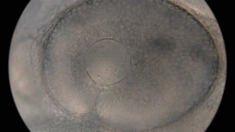 Not yet fully formed eye of a fish embryo, under a microscope Stock Footage 97761991