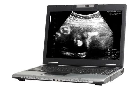 Notebook computer  on white background with blank screen, clipping path inclu Stock Photos