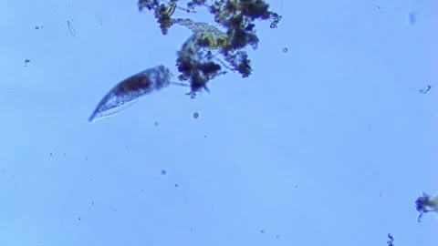 Notholca acuminata and freshwater algae bloom-100x Stock Footage 302708936