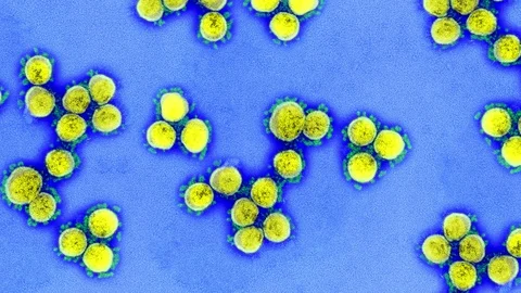 Novel Corona virus SARS-CoV-2 under microscope Stock Footage
