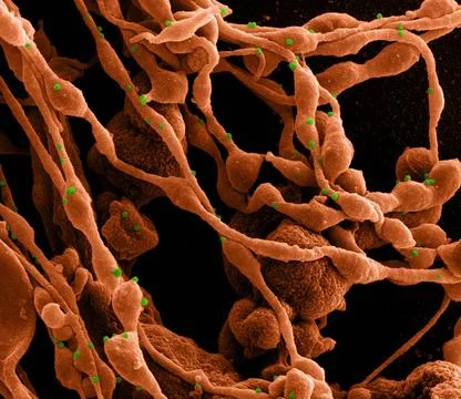  Novel Coronavirus SARS-CoV-2 Colorized scanning electron micrograph of a ... Stock Photos