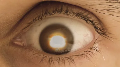 Nuclear explosion seen through my eyes 4k Stock Footage 175344312