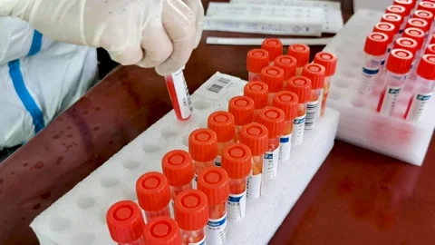 Nucleic acid detection for the COVID-19 virus Stock Footage 184200804