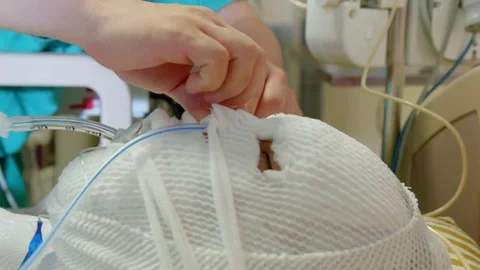 Nurse adjusting tubes on fully bandaged person Stock Footage
